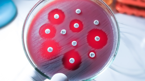 Eesti võtab kasutusele antibiootikumkindluse vastase plaani