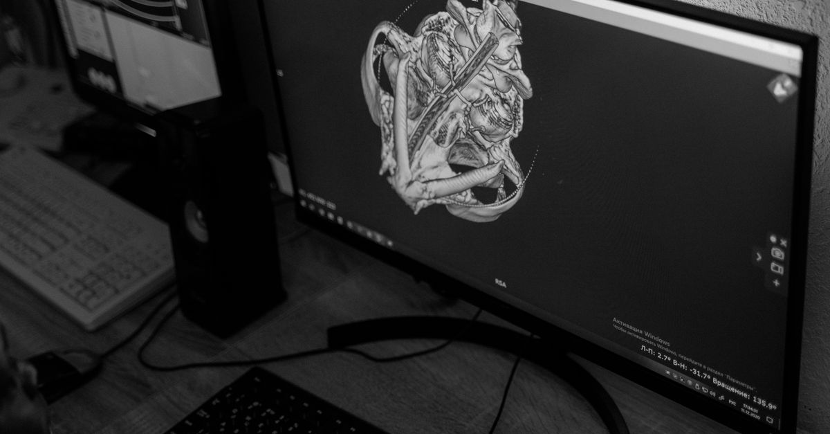 3D-визуализация революционизирует кардиологические операции