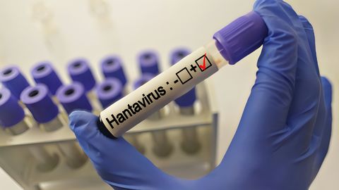 Hantaviirus kruiisilaeval: epidemioloogid rahul jäävad