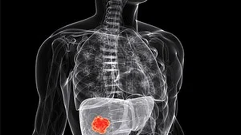 London clinic offers industrial bleach as cancer "cure"
