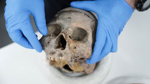 Находка возрастом 1400 лет: лангобардская женщина получила две тяжёлые травмы головы
