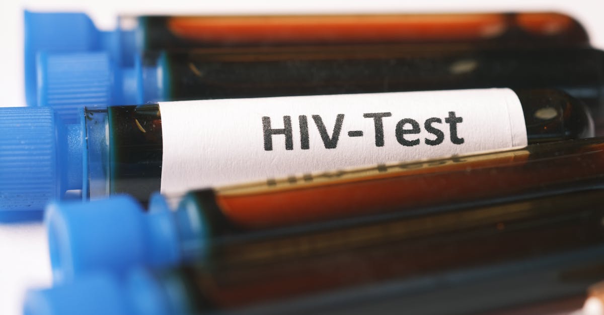 Eestis käivitus tasuta HIV-testimise nädal