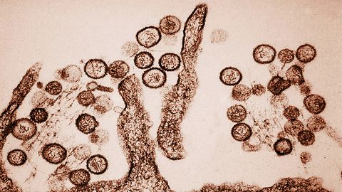 Horizon's big story: A cruise ship on the Atlantic and trench nephritis
