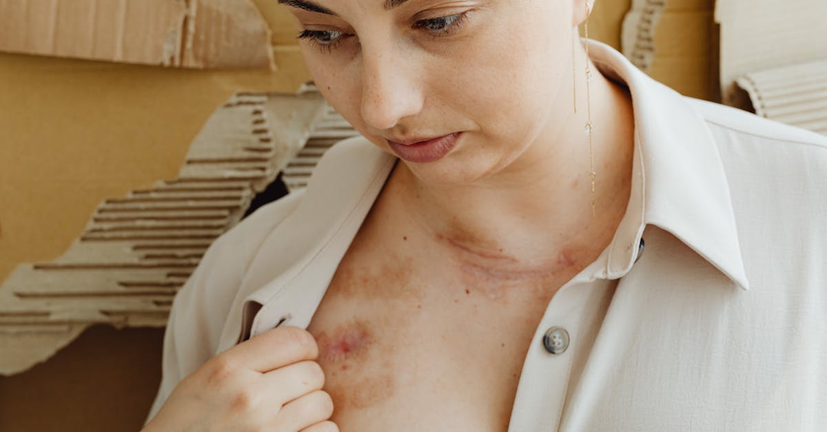 Medical Mystery: Hundreds Report Skin Condition Doctors Debate