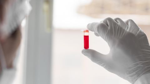 Terviseamet: hantaviirus pole suureks ohuks Euroopal