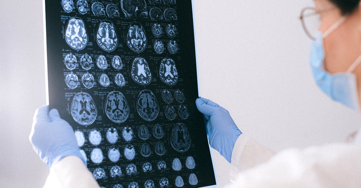 Herpes Virus Led to Severe Brain Damage in Estonian Woman