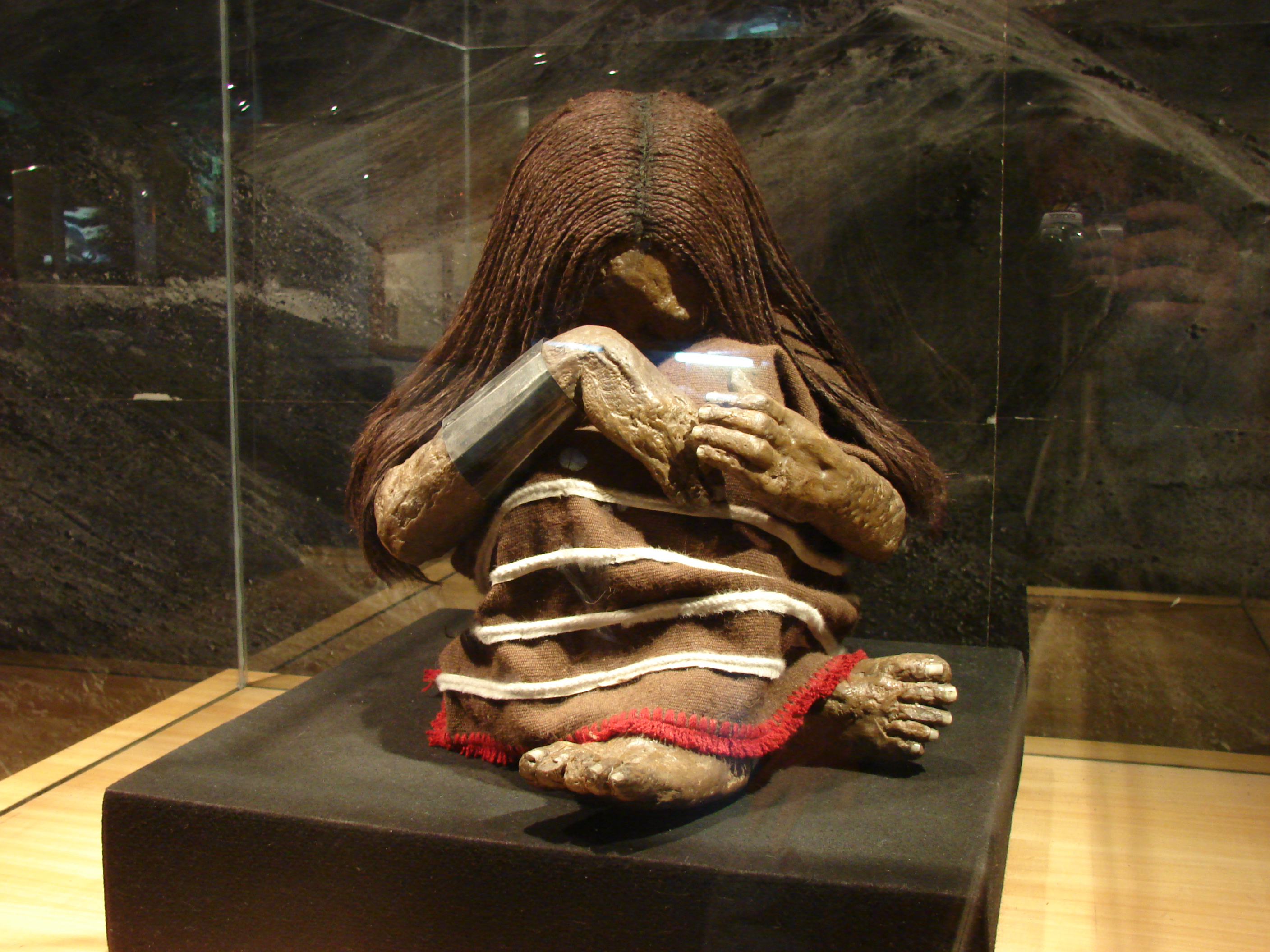 Scientists discover microbes living for over 5,000 years on ice mummy Ötzi