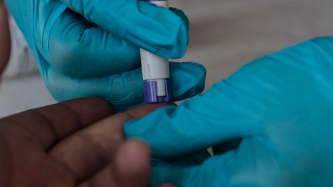 Euroopa kogu nakkushaiguste kriis jõudis Eestisse: tripper ja süüfilis levivad rekorditempo