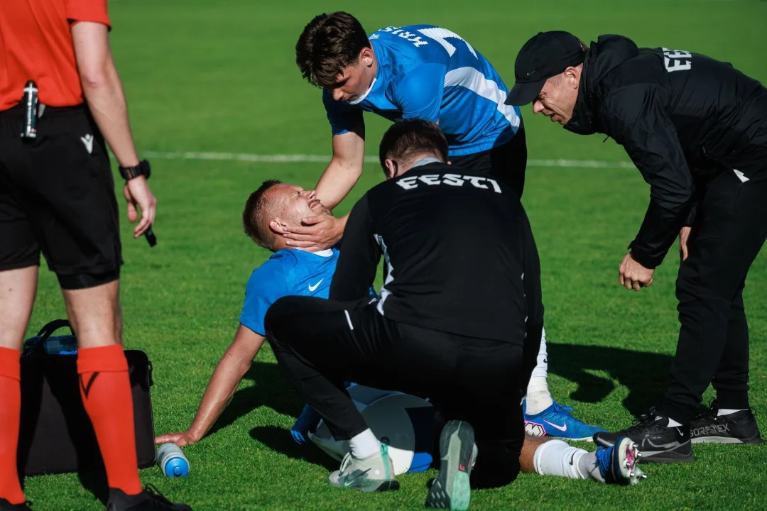 Estonia's striker Lepik suffers serious knee injury, but stays with team