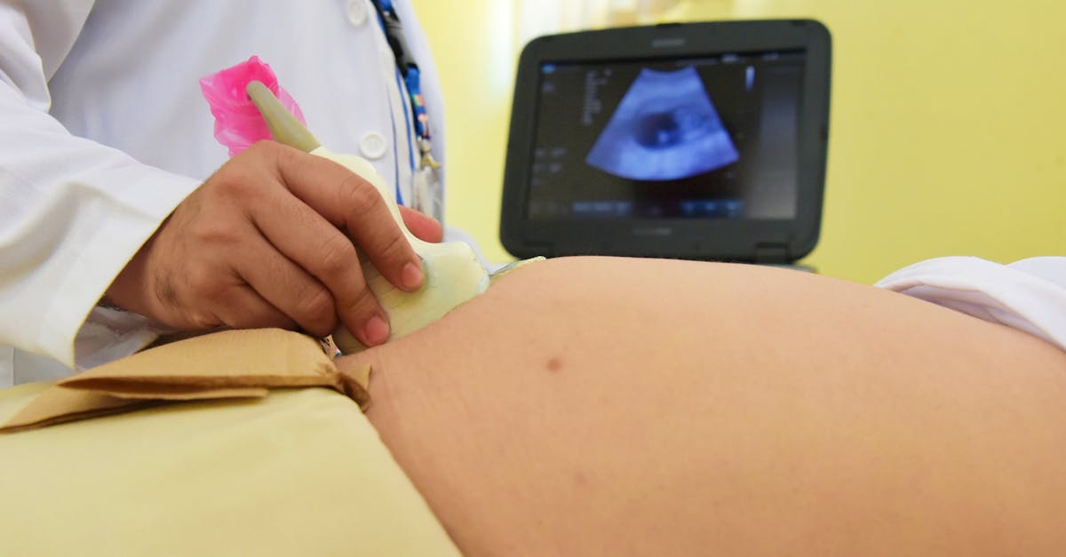 Fetal Blood Transfusion Saves Unborn Baby's Life